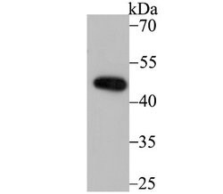 XPE/DDB2 Rabbit anti-Human, Clone: JE16-41, Novus Biologicals 100 &mu;l;